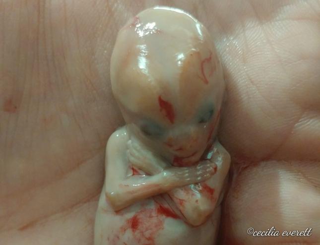 12 weeks miscarried baby abortions nz 4